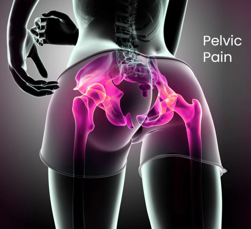 Chronic Pelvic Pain